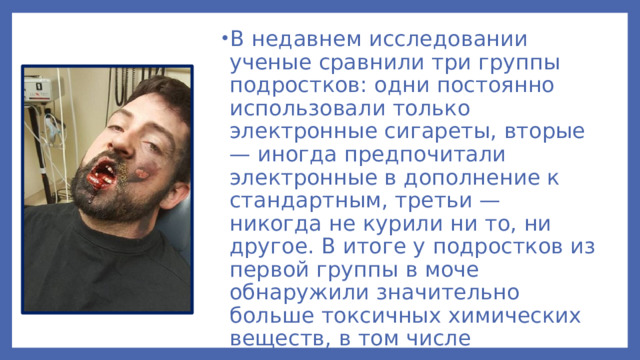 В недавнем исследовании ученые сравнили три группы подростков: одни постоянно использовали только электронные сигареты, вторые — иногда предпочитали электронные в дополнение к стандартным, третьи — никогда не курили ни то, ни другое. В итоге у подростков из первой группы в моче обнаружили значительно больше токсичных химических веществ, в том числе акрилонитрил, акролеин, оксид пропилена, акриламид и кротоновый альдегид.